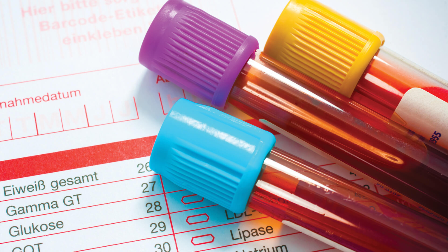 Laboratory Diagnostics Specialty Esters Kensing Solutions